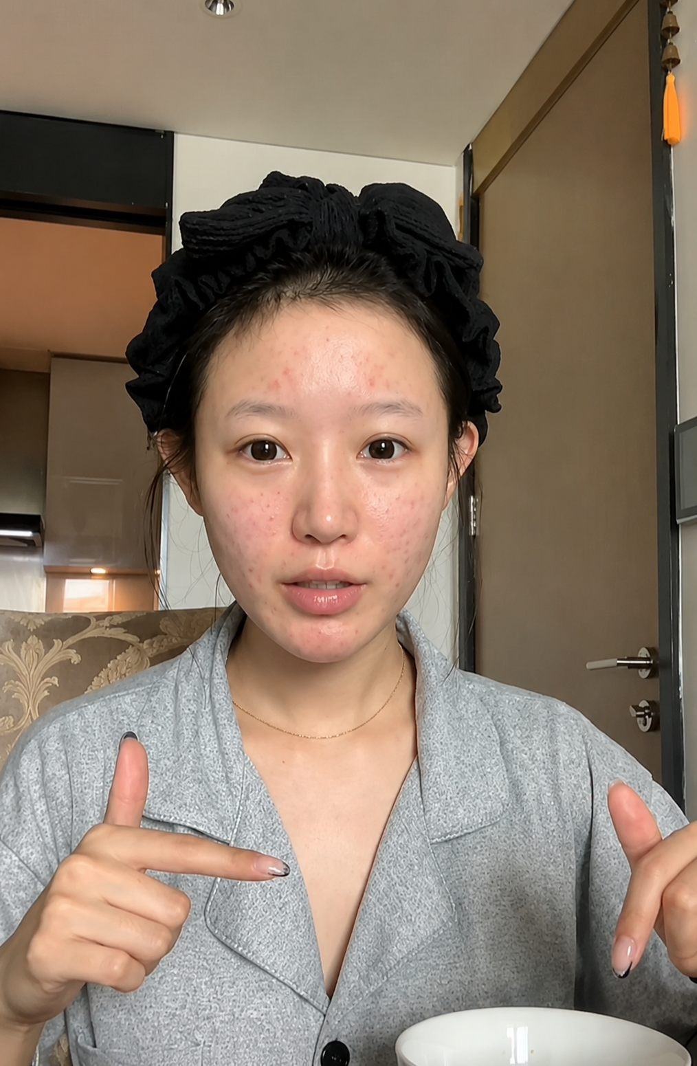 비포1